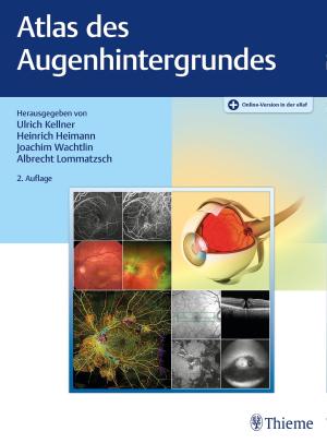 Heinrich Heimann, Ulrich Kellner, Albrecht Peter Lommatzsch, Joachim Wachtlin: Atlas des Augenhintergrundes 